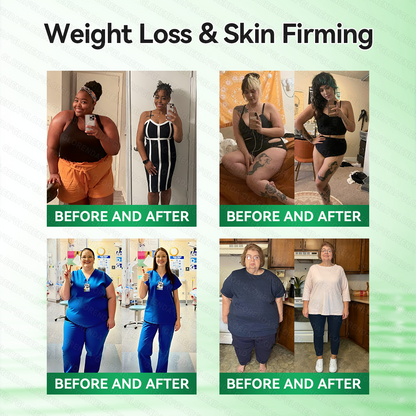 𝑶𝒇𝒇𝒊𝒄𝒊𝒂𝒍 𝑺𝒕𝒐𝒓𝒆  |  💯 💯 𝐂𝐚𝐫𝐞𝐔𝐩𝐥𝐢𝐟𝐭® 𝙈𝒐𝒓𝒊𝒏𝒈𝗮 · 𝗕𝗲𝗿𝗯𝐞𝐫𝐢𝐧𝙚 × 𝙉𝑨𝑫+ 𝟏𝟎-𝙞𝙣-𝟏 𝘼𝒅𝒗𝒂𝒏𝒄𝒆𝐝 𝐍𝐚𝐧𝙤 𝙈𝙞𝙘𝙧𝙤𝙣𝒆𝒆𝒅𝒍𝐞 𝐏𝐚𝐭𝙘𝙝(𝐉𝐮𝐬𝐭 𝐨𝐧𝐜𝐞 𝐚 𝐝𝐚𝐲, 𝐯𝐢𝐬𝐢𝐛𝐥𝐞 𝐜𝐡𝐚𝐧𝐠𝐞𝐬 𝐢𝐧 𝟕 𝐝𝐚𝐲𝐬） ✅ 𝐅𝐨𝐫 𝐨𝐛𝐞𝐬𝐢𝐭𝐲, 🅛🅞🅞🅢🅔 🅢🅚🅘🅝,𝐝𝐢𝐚𝐛𝐞𝐭𝐞𝐬, 𝐬𝐥𝐞𝐞𝐩 𝐚𝐩𝐧𝐞𝐚, 𝐣𝐨𝐢𝐧𝐭 𝐢𝐬𝐬𝐮𝐞𝐬, 𝐚𝐧𝐝 𝐦𝐨𝐫𝐞💖