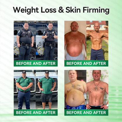 𝑶𝒇𝒇𝒊𝒄𝒊𝒂𝒍 𝑺𝒕𝒐𝒓𝒆  |  💯 💯 𝐂𝐚𝐫𝐞𝐔𝐩𝐥𝐢𝐟𝐭® 𝙈𝒐𝒓𝒊𝒏𝒈𝗮 · 𝗕𝗲𝗿𝗯𝐞𝐫𝐢𝐧𝙚 × 𝙉𝑨𝑫+ 𝟏𝟎-𝙞𝙣-𝟏 𝘼𝒅𝒗𝒂𝒏𝒄𝒆𝐝 𝐍𝐚𝐧𝙤 𝙈𝙞𝙘𝙧𝙤𝙣𝒆𝒆𝒅𝒍𝐞 𝐏𝐚𝐭𝙘𝙝(𝐉𝐮𝐬𝐭 𝐨𝐧𝐜𝐞 𝐚 𝐝𝐚𝐲, 𝐯𝐢𝐬𝐢𝐛𝐥𝐞 𝐜𝐡𝐚𝐧𝐠𝐞𝐬 𝐢𝐧 𝟕 𝐝𝐚𝐲𝐬） ✅ 𝐅𝐨𝐫 𝐨𝐛𝐞𝐬𝐢𝐭𝐲, 🅛🅞🅞🅢🅔 🅢🅚🅘🅝,𝐝𝐢𝐚𝐛𝐞𝐭𝐞𝐬, 𝐬𝐥𝐞𝐞𝐩 𝐚𝐩𝐧𝐞𝐚, 𝐣𝐨𝐢𝐧𝐭 𝐢𝐬𝐬𝐮𝐞𝐬, 𝐚𝐧𝐝 𝐦𝐨𝐫𝐞💖